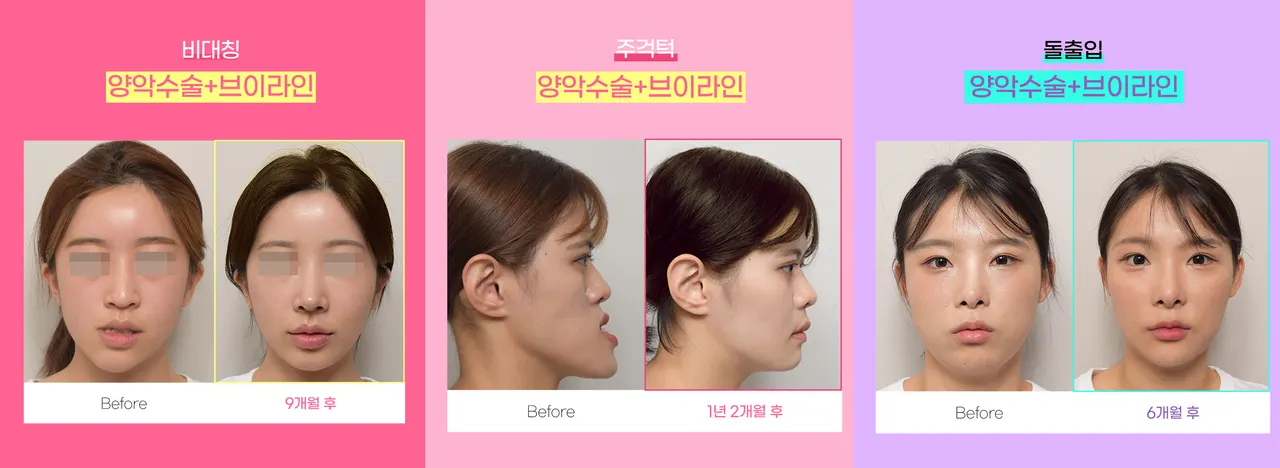 이유(eu)구강악안면외과 치과의원 (7)